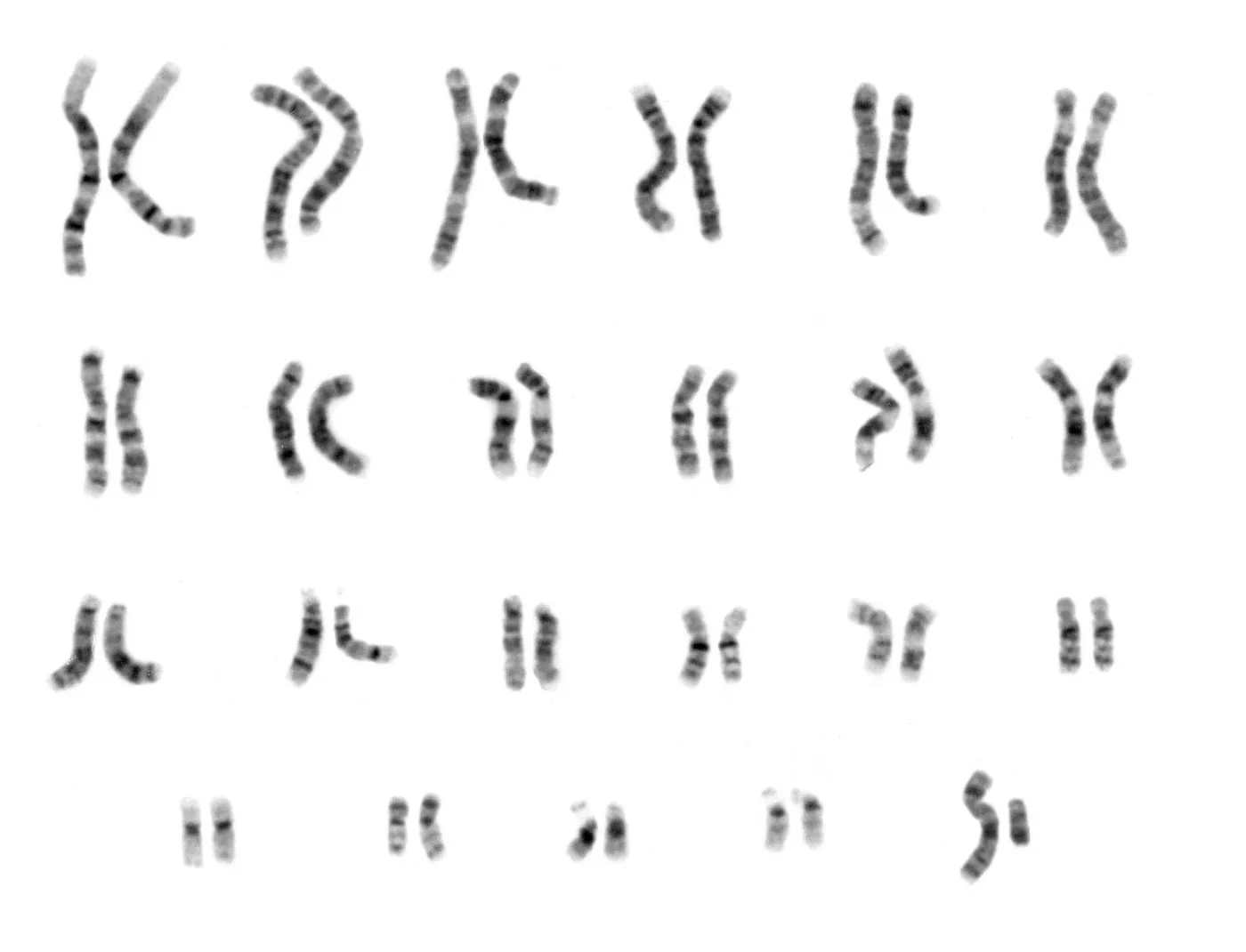 A composite photograph of the chromosomes of a human male, called a karyotype.