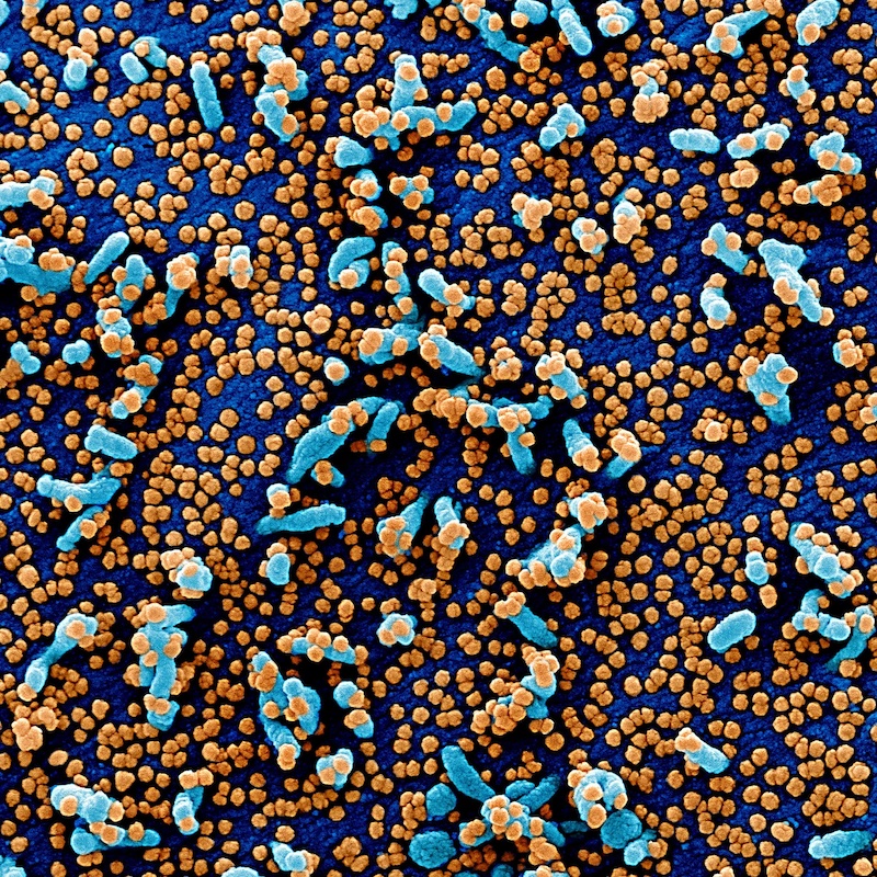 Colorized SEM from <a href="https://microbenotes.com/electron-microscopy-images-of-sars-cov-2/">the NIAID Integrated Research Facility (IRF) in Fort Detrick, Maryland</a>. Unfortunately there is no scale bar.