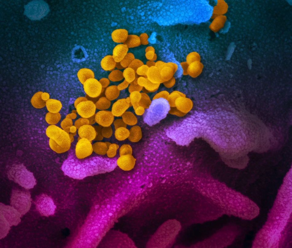 Another colorized SEM, also from <a href="https://microbenotes.com/electron-microscopy-images-of-sars-cov-2/">NIAID</a>. Still no scale bar.