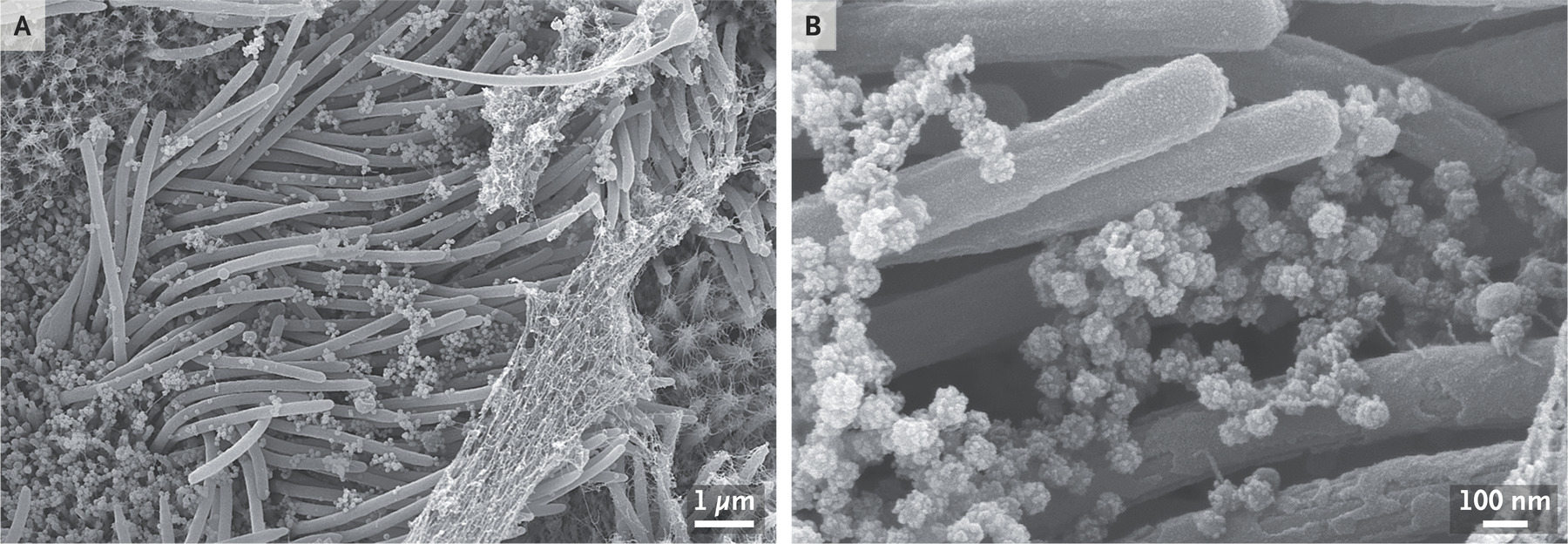 My favorite, this stunning work from Dr. Camille Ehre at <a href="https://www.nejm.org/doi/full/10.1056/NEJMicm2023328">UNC Chapel Hill</a>. No colorization, and it includes a scale bar! Click to zoom.